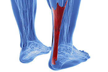 Achilles tendonitis treatment in the Clark County, NV: Las Vegas (Paradise, Summerlin South, Spring Valley, Enterprise, Winchester, Sunrise Manor, Sloan, Blue Diamond, Henderson) areas