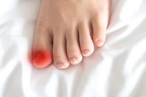 Reasons an Ingrown Toenail May Develop