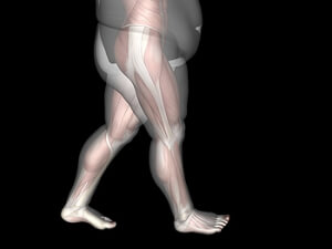 The Relationship Between Obesity and Foot Pain