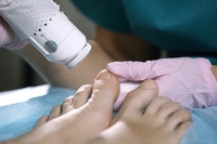 Why Laser Therapy Is Effective in Treating Toenail Fungus
