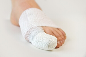 Is My Toe Sprained or Is It Broken?